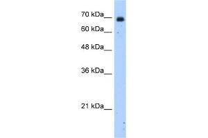 WB Suggested Anti-HSZFP36 Antibody Titration:  2. (ZNF823 anticorps  (N-Term))