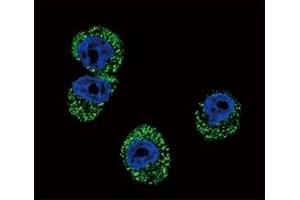 Confocal immunofluorescent analysis of CCR7 antibody with MDA-MB231 cells followed by Alexa Fluor 488-conjugated goat anti-rabbit lgG (green).