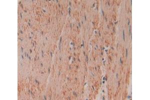 Used in DAB staining on fromalin fixed paraffin- embedded Kidney tissue (Gelsolin anticorps  (AA 434-782))