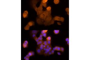 Immunofluorescence analysis of MCF7 cells using Galectin 3/LG Rabbit mAb (ABIN7267337) at dilution of 1:50 (40x lens).