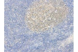 ABIN6264360 and ABIN6278002 at 1/100 staining human normal tonsil tissue by IHC-P. (POU2AF1 anticorps  (C-Term))