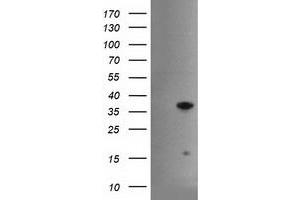 Western Blotting (WB) image for anti-Hes Family bHLH Transcription Factor 1 (HES1) antibody (ABIN1498637) (HES1 anticorps)