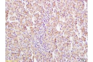 Formalin-fixed and paraffin embedded rat liver tissue labeled Anti-GHR Polyclonal Antibody, Unconjugated  at 1:400, followed by conjugation to the secondary antibody and DAB staining (Growth Hormone Receptor anticorps  (AA 101-200))