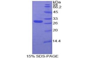 SDS-PAGE analysis of Human MMP16 Protein.