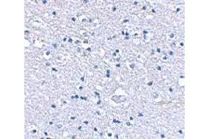 Immunohistochemical staining of human brain tissue using AP30385PU-N Grik4 antibody at 2.