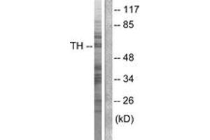 Western blot analysis of extracts from NIH-3T3 cells, treated with Forskolin 40nM 30', using Tyrosine Hydroxylase (Ab-40) Antibody.