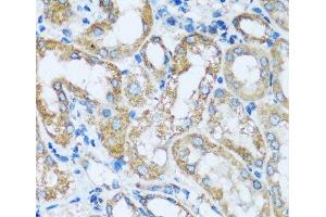 Immunohistochemistry of paraffin-embedded Mouse kidney using ARHGEF5 Polyclonal Antibody at dilution of 1:100 (40x lens). (ARHGEF5 anticorps)