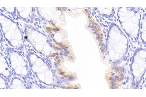 Detection of GAL3 in Rat Colon Tissue using Monoclonal Antibody to Galectin 3 (GAL3)