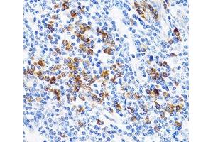Immunohistochemistry of paraffin-embedded Human tonsil using TNFSF12 Polyclonal Antibody at dilution of 1:100 (40x lens). (TWEAK anticorps)