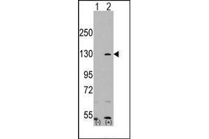 Western blot analysis of PARP1 (arrow) using rabbit polyclonal PARP1 Antibody