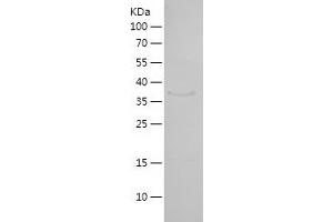 Western Blotting (WB) image for Ha-Ry/enhancer-of-Split Related with YRPW Motif 1 (HEY1) (AA 156-304) protein (His-IF2DI Tag) (ABIN7123248)