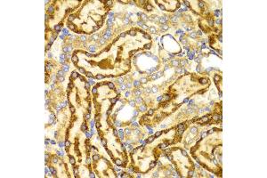 Immunohistochemistry of paraffin-embedded rat kidney using LAMP3 antibody (ABIN5971497) at dilution of 1/100 (40x lens). (LAMP3 anticorps)