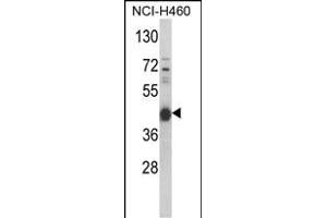 Western blot analysis of PRKACA Antibody (N-term K82) (ABIN390798 and ABIN2841043) in NCI- cell line lysates (35 μg/lane). (PRKACA anticorps  (N-Term))