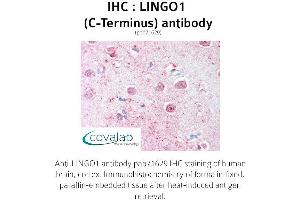 Image no. 1 for anti-Leucine Rich Repeat and Ig Domain Containing 1 (LINGO1) (C-Term) antibody (ABIN1736452) (LINGO1 anticorps  (C-Term))