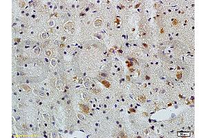 Formalin-fixed and paraffin embedded mouse kidney labeled with Rabbit Anti-APG5L/ATG5 Polyclonal Antibody (ABIN752413) at 1:100 followed by conjugation to the secondary antibody and DAB staining. (ATG5 anticorps  (AA 101-200))