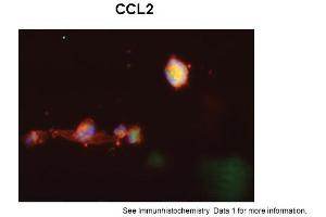 Sample Type: Human Macrophange CellsGreen: primaryRed: phallodinBlue: DAPIYellow: green/redPrimary Dilution: 1:200Secondary Antibody: anti-Rabbit IgG-FITCSecondary Dilution: 1:1000Image Submitted By: Milan FialaUniversity of California, Los Angeles (CCL2 anticorps  (Middle Region))