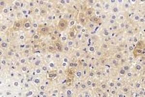 Immunohistochemistry analysis of paraffin-embedded mouse liver using Endostatin (ABIN7073823) at dilution of 1:1200 (COL18A1 anticorps)