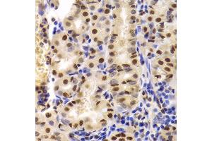 Immunohistochemistry of paraffin-embedded human stomach using XRCC5 Antibody. (XRCC5 anticorps  (AA 543-732))