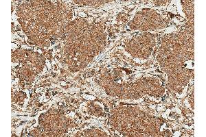 Immunohistochemistry analysis using Rabbit Anti-ROR1 Polyclonal Antibody (ABIN5667800).