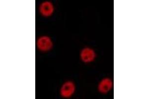ABIN6277629 staining Hela by IF/ICC. (PRDM14 anticorps  (N-Term))