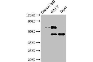 Immunoprecipitating GALT in HepG2 whole cell lysate Lane 1: Rabbit control IgG instead of ABIN7153422 in HepG2 whole cell lysate. (GALT anticorps  (AA 1-379))