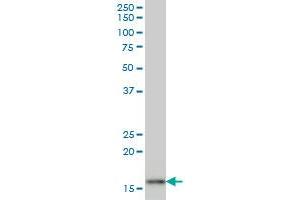 AGR2 monoclonal antibody (M03), clone 1C3 Western Blot analysis of AGR2 expression in MCF-7 . (AGR2 anticorps  (AA 1-175))