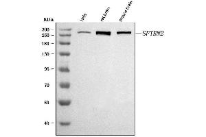 Western blot analysis of SPTBN2 using anti-SPTBN2 antibody (ABIN7602111). (Spectrin, Beta, Non-erythrocytic 2 (SPTBN2) (AA 594-1909) anticorps)