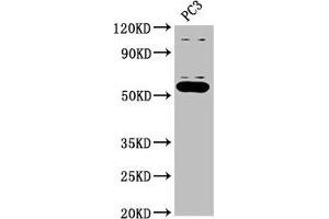 Western Blot Positive WB detected in: PC-3 whole cell lysate All lanes: OMA1 antibody at 2. (OMA1 anticorps  (AA 22-194))