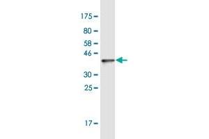 Western Blot detection against Immunogen (37.