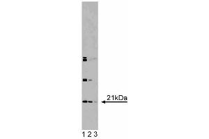 Western blot analysis of DHFR on RSV-3T3 lysate. (Dihydrofolate Reductase anticorps  (AA 1-186))