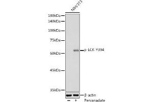 Western blot analysis of extracts of NIH/3T3 cells, using Phospho-LCK-Y394 antibody (ABIN3019739, ABIN3019740, ABIN3019741 and ABIN7101863) at 1:1000 dilution. (LCK anticorps  (pTyr394))