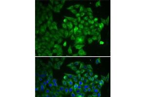 Immunofluorescence analysis of U2OS cells using RAF1 Polyclonal Antibody