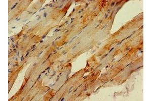 Immunohistochemistry of paraffin-embedded human skeletal muscle tissue using ABIN7151009 at dilution of 1:100 (STUB1 anticorps  (AA 1-48))