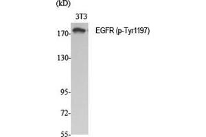Western Blot (WB) analysis of specific cells using Phospho-EGFR (Y1197) Polyclonal Antibody. (EGFR anticorps  (pTyr1197))