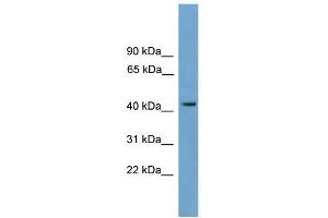 WB Suggested Anti-MFSD3 Antibody Titration:  0. (MFSD3 anticorps  (Middle Region))