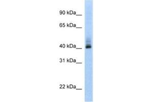 Western Blotting (WB) image for anti-Ankyrin Repeat Domain 42 (ANKRD42) antibody (ABIN2462361) (ANKRD42 anticorps)