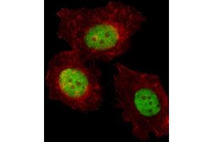 Fluorescent image of MCF-7 cell stained with TREF1 Antibody (C-term) (ABIN653305 and ABIN2842805).