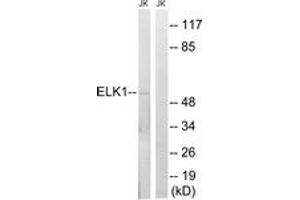 Western blot analysis of extracts from JurKat cells, using Elk1 (Ab-383) Antibody. (ELK1 anticorps  (AA 351-400))