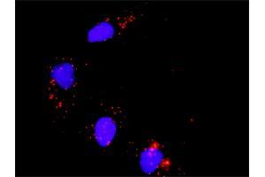 Proximity Ligation Analysis of protein-protein interactions between MAPK3 and ATF2. (ATF2 anticorps  (AA 91-190))