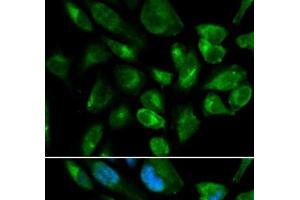 Immunofluorescence analysis of HepG2 cells using KIR2DL3 Polyclonal Antibody (KIR2DL3 anticorps)