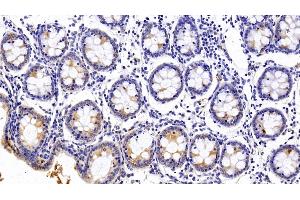 Detection of PALLD in Human Colon Tissue using Polyclonal Antibody to Palladin (PALLD) (PALLD anticorps  (AA 1137-1383))