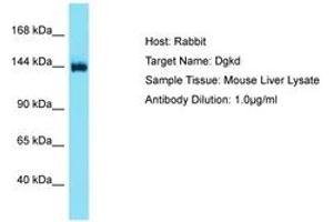 Image no. 1 for anti-Diacylglycerol Kinase, delta 130kDa (DGKD) (AA 449-498) antibody (ABIN6750521) (DGKD anticorps  (AA 449-498))