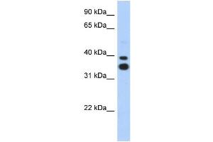 WB Suggested Anti-MSX2 Antibody Titration: 0. (Msx2/Hox8 anticorps  (N-Term))