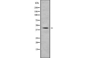 Western blot analysis NFKBIL1 using HepG2 whole cell lysates (NFKBIL1 anticorps  (Internal Region))