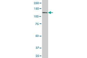 EPB41L3 monoclonal antibody (M01), clone 2B1 Western Blot analysis of EPB41L3 expression in HepG2 .