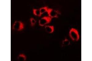 Immunofluorescent analysis of RNF81 staining in SW620 cells. (TRIM21 anticorps)