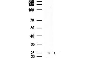 anti-Interferon, alpha 5 (IFNA5) antibody