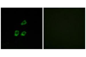 Immunofluorescence analysis of HUVEC cells, using CLCN4 antibody. (CLCN4 anticorps  (Internal Region))