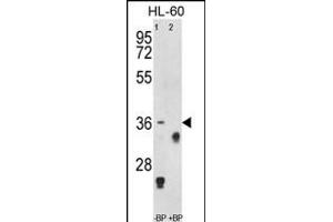 Western blot analysis of anti-TNFRSF14 Antibody (Center) Pab (ABIN653038 and ABIN2842652) pre-incubated without(lane 1) and with(lane 2) blocking peptide in HL-60 cell line lysate. (HVEM anticorps  (AA 210-236))