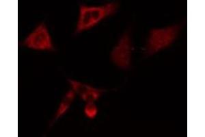 ABIN6275071 staining  A549 cells by IF/ICC.